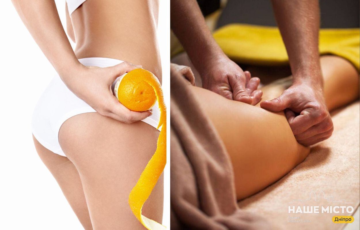 Антицелюлітний масаж у Дніпрі: де і за яку ціну?