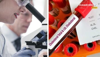 Як перевірити рівень холестерину в Дніпрі: лабораторії та вартість