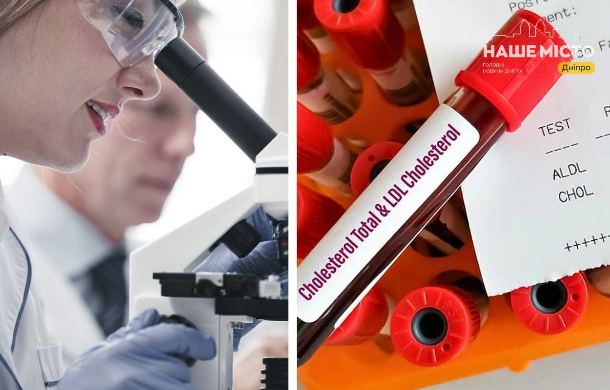 Як перевірити рівень холестерину в Дніпрі: лабораторії та вартість